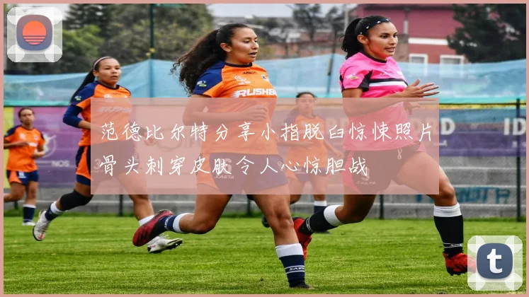范德比尔特分享小指脱臼惊悚照片骨头刺穿皮肤令人心惊胆战
